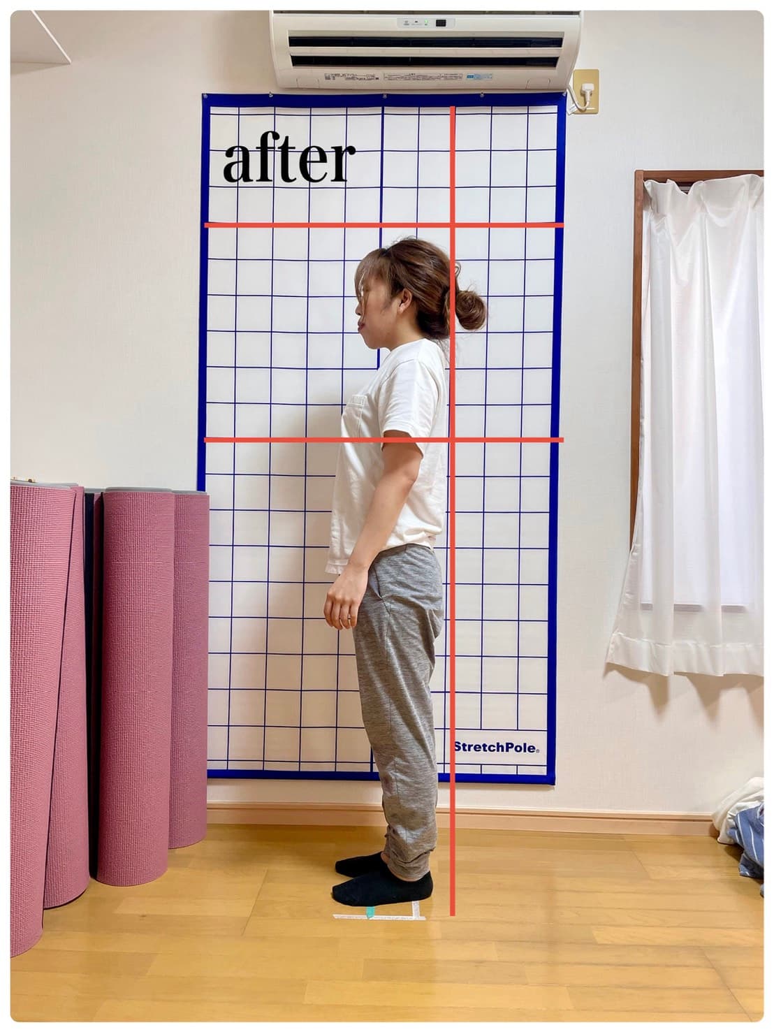 20代女性 アフター